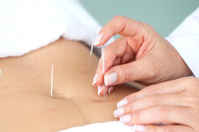 Acupuncture Pain Relief